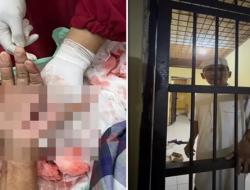 Ironi Tokoh Kampung Jeneponto, Dikeroyok hingga Tangan Nyaris Putus lalu Masuk Penjara