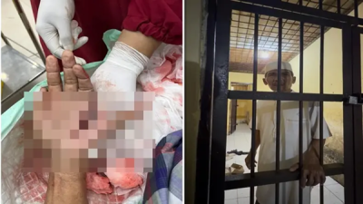 Ironi Tokoh Kampung Jeneponto, Dikeroyok hingga Tangan Nyaris Putus lalu Masuk Penjara